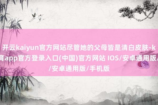 开云kaiyun官方网站尽管她的父母皆是清白皮肤-kai云体育app官方登录入口(中国)官方网站 IOS/安卓通用版/手机版